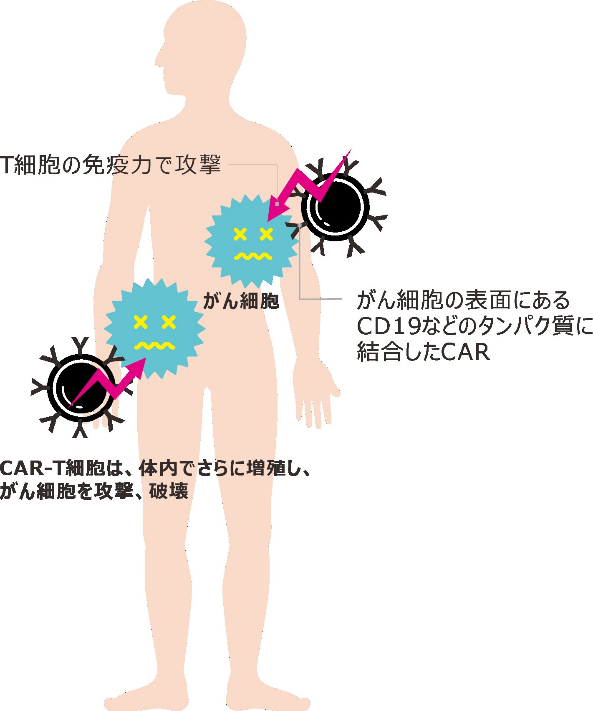 体内で増殖し、がんを攻撃するCAR-T細胞（イメージ）