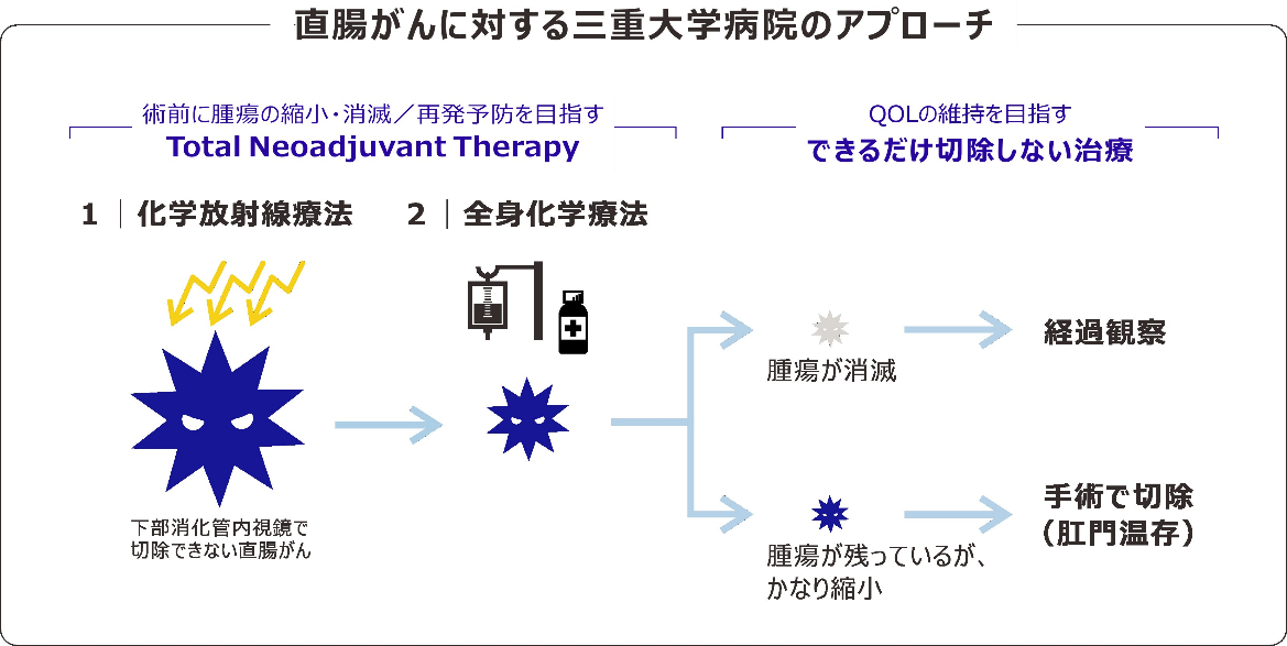 できるだけ“切らない”直腸がんの最新治療 - Online MEWS