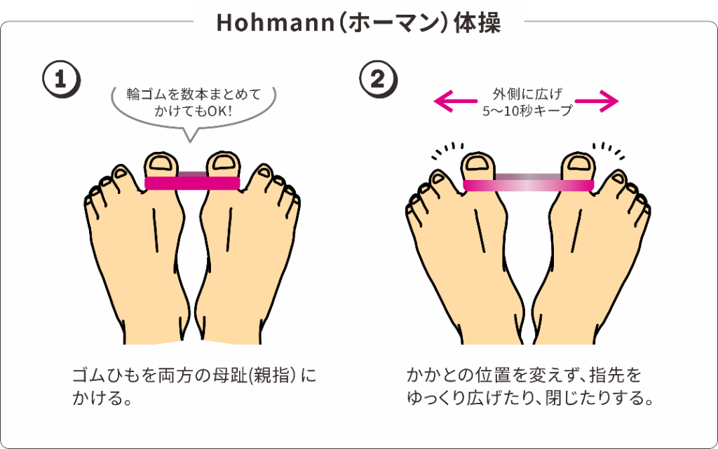 Hohmann（ホーマン）体操